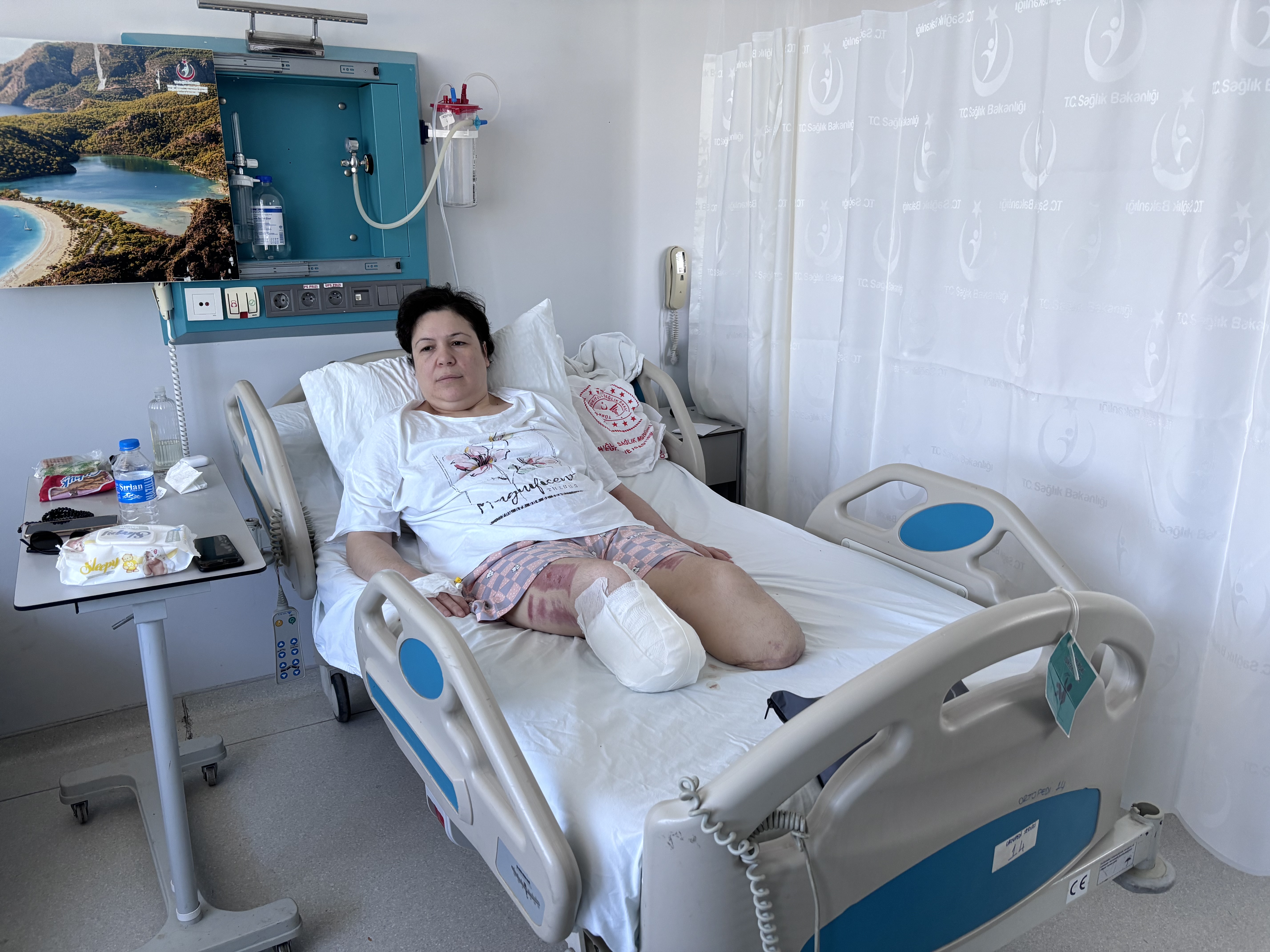 Boşanmak istediği eşi tarafından vurulmuştu... İki bacağını kaybeden Hatice K’nın davasında ikinci duruşma yarın