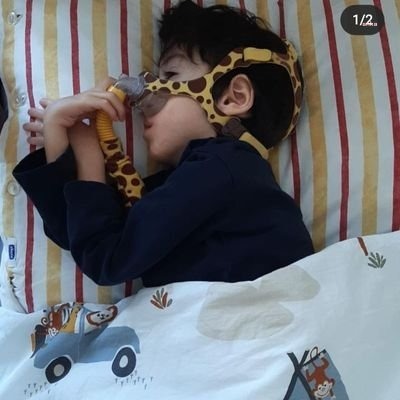 İZMİT BELEDİYESİ ‘SMA DEĞİL BARKIN KAZANSIN’ SLOGANI İLE 4.5 YAŞINDAKİ SMA HASTASI BARKIN KAPLAN İÇİN YARDIM GECESİ DÜZENLEYECEK