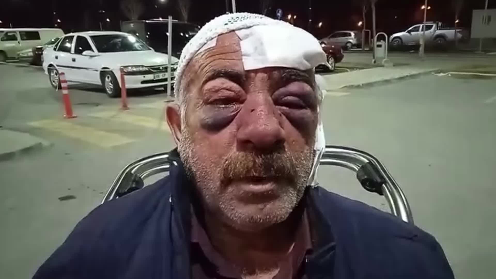 KONYA'DA BİR VATANDAŞ, HUSUMETLİLERİ TARAFINDAN KARAKOLDA DARP EDİLDİĞİ İDDİASIYLA ŞİKAYETTE BULUNDU