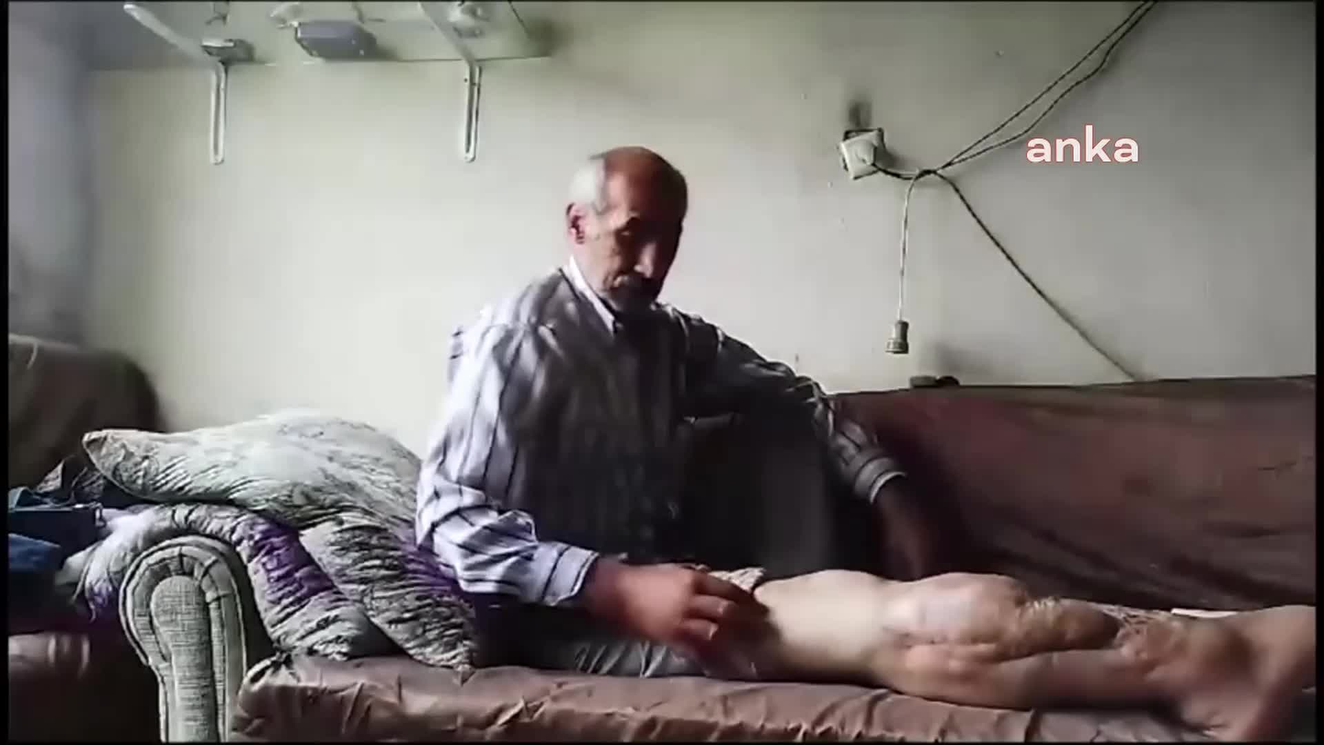 SİNOP’TA 7 YILDIR KIRIK BACAĞI İLE YAŞAM MÜCADELESİ VEREN UĞUR: "SON BİR AMELİYATIM KALDI FAKAT O AMELİYATIMI OLAMADIM. ŞU ANDA MADDİ İMKANIM SIFIR"