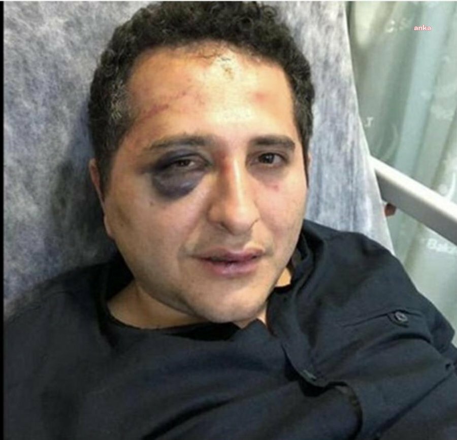 CUMHURBAŞKANININ YAKIN KORUMLARININ AVUKATI DARP ETTİĞİ İDDİASIYLA YARGILANDIĞI DAVADA DOSYA 'İŞKENCE SUÇU' İHTİMALİYLE AĞIR CEZA MAHKEMESİNE GÖNDERİLDİ
