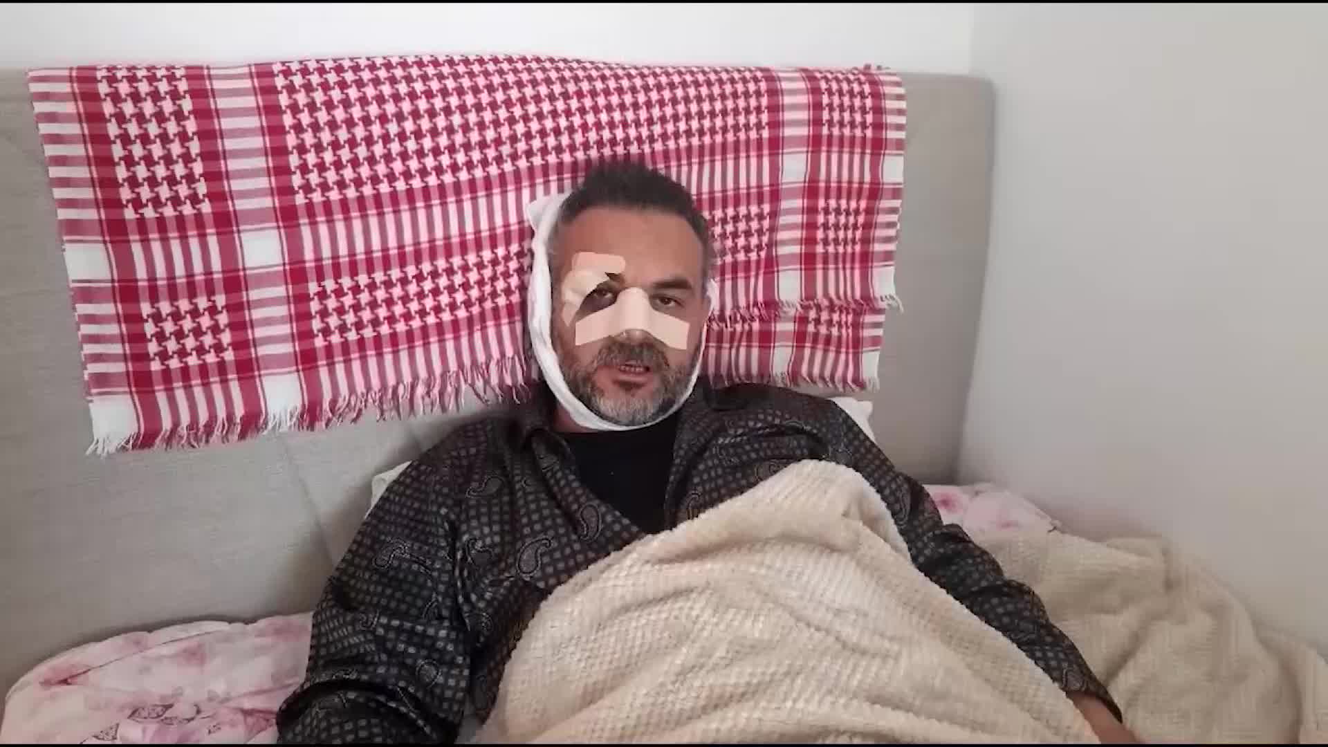 Rize'de bir yemek zinciri şubesinin açılışında İsrail'i protesto eden öğretim görevlisine saldıran iki kişi  serbest bırakıldı
