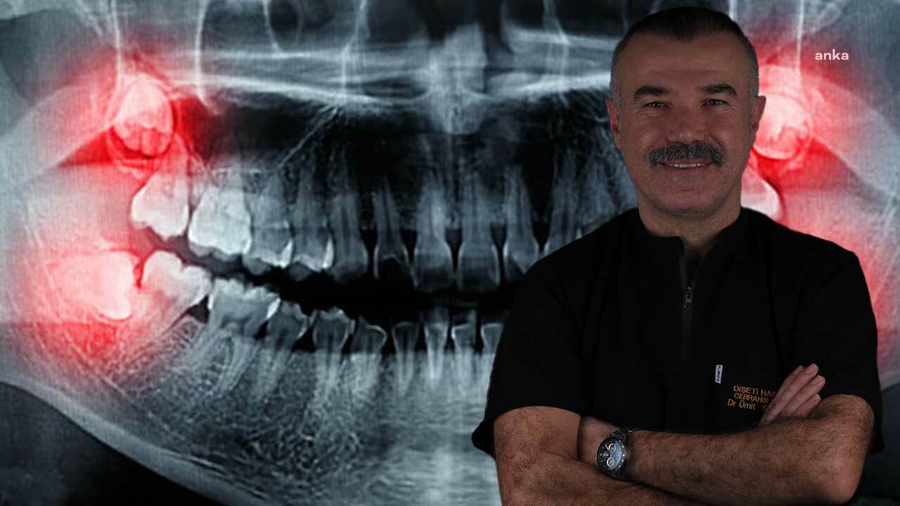 Yirmilik dişler ihmale gelmiyor! Uzmanı uyardı: "Gülüşünüz bozulabilir"