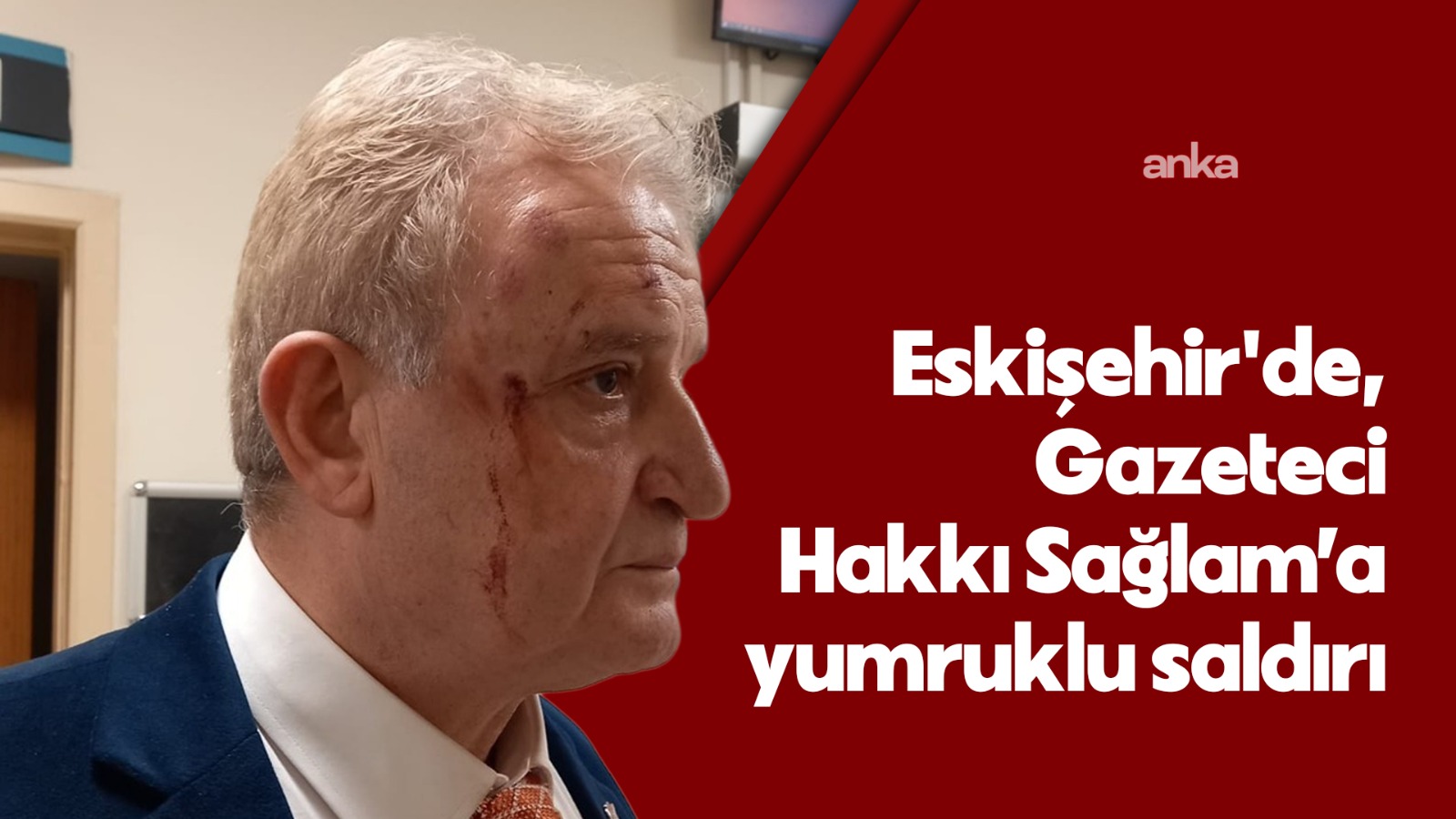 Eskişehir'de gazeteci Hakkı Sağlam’a yumruklu saldırı