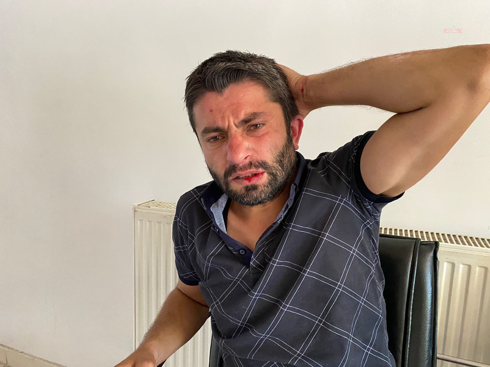 GAZİANTEP’TE GAZETECİYE SALDIRI